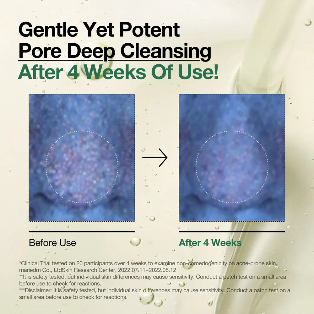 Anua heartleaf pore cleansing oil effectiveness after 4 weeks use, showing before and after pore deep cleansing results.