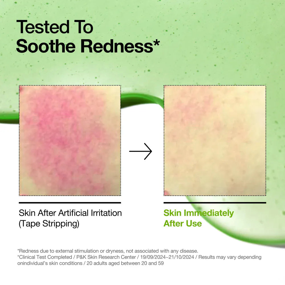 Comparison of skin before and after using Anua Azelaic Acid 10 + Hyaluron Redness Soothing Serum showing reduced redness.