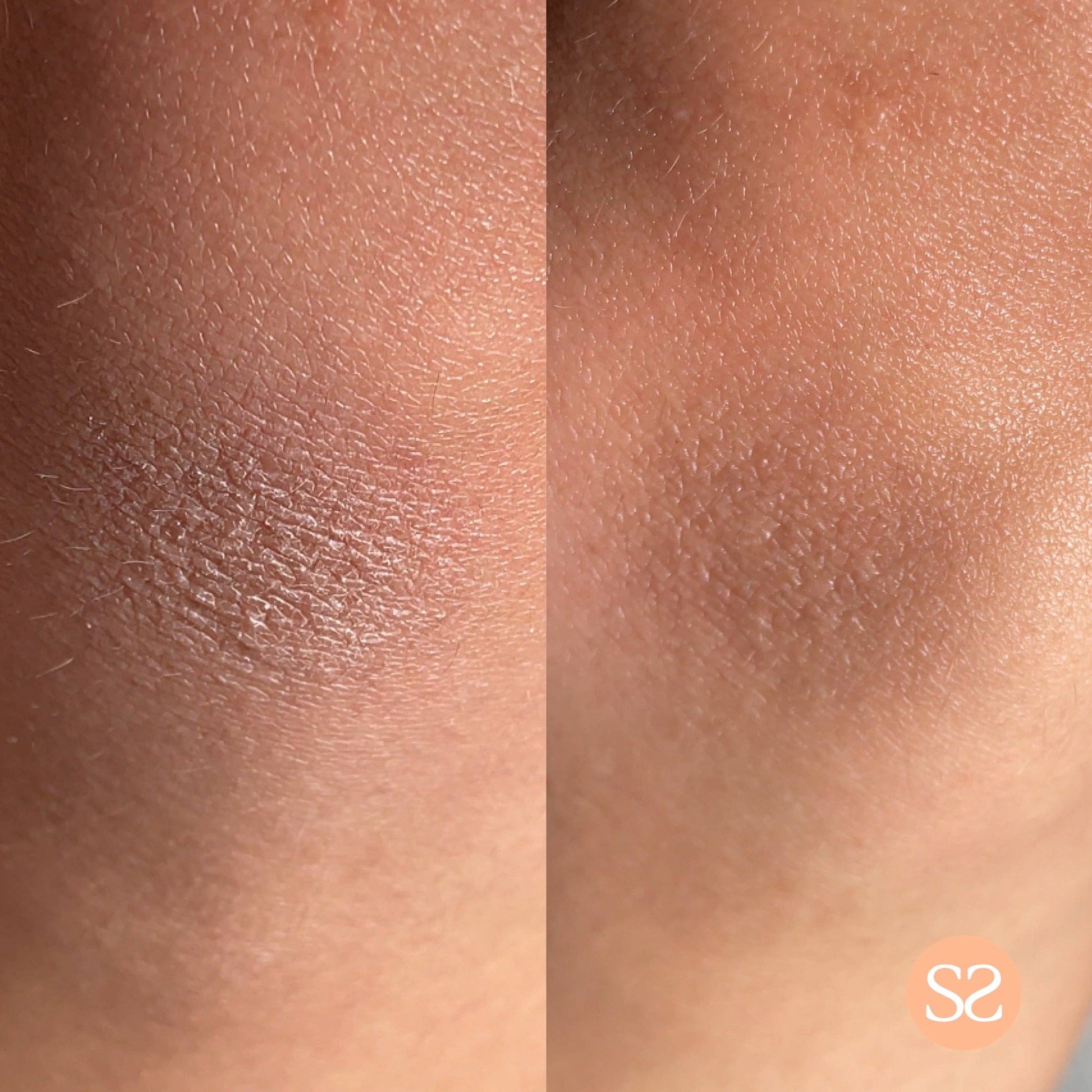 Before and after using Simply Self Super Soft Body Moisturiser, showing improved skin texture and hydration.