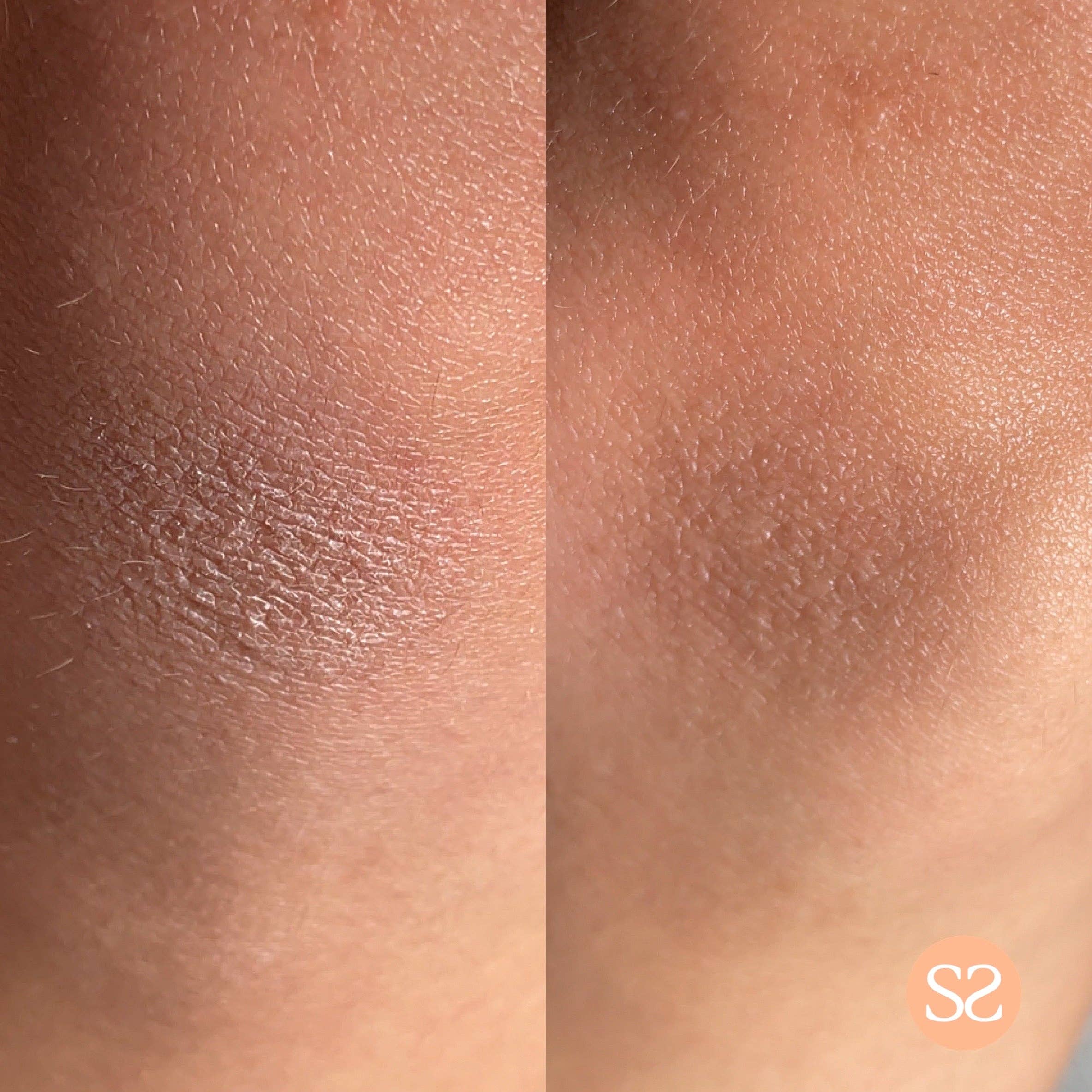 Before and after using Simply Self Super Soft Body Moisturiser, showing improved skin texture and hydration.