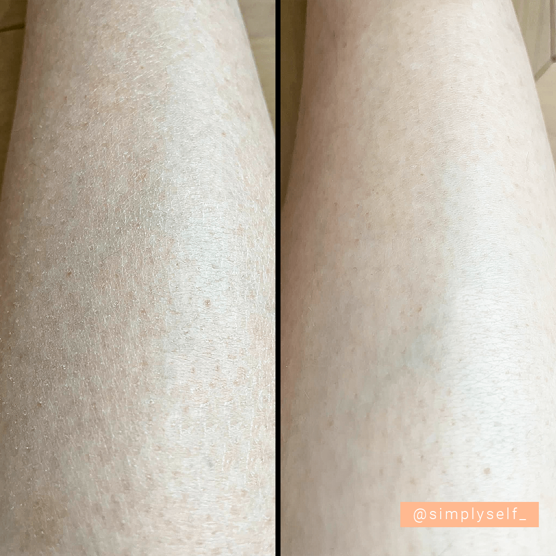 Before and after using Simply Self Silky Smooth Body Scrub, showing improved skin texture and hydration on legs.