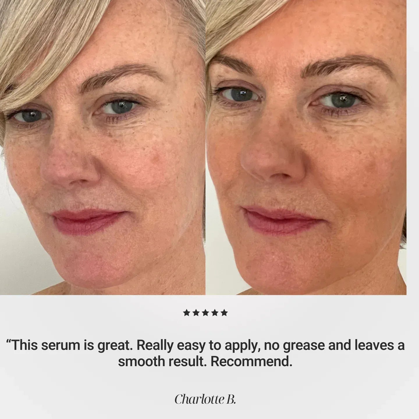 Before and after results using Vita Tanning Anti-Age Face Serum showing improved skin texture and glow.